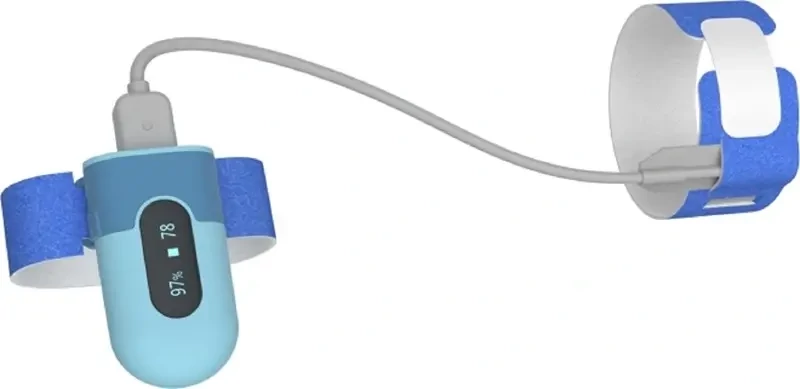 okos-legzesfigyelo-viatomtol