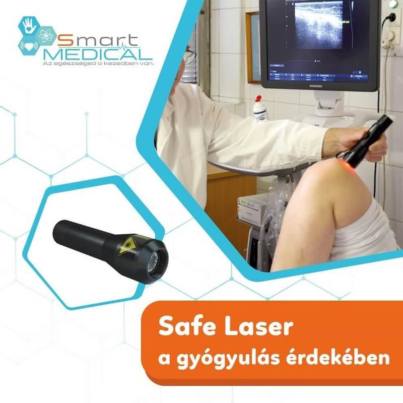Safe Laser kezelés SmartMedical