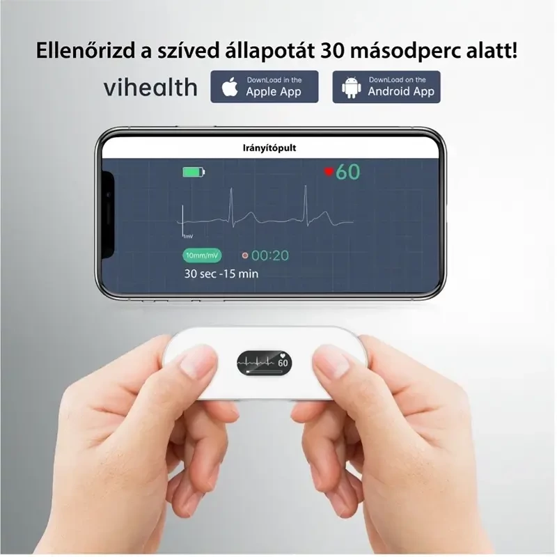 viatom-duoekg-s-okos-ekg-egeszsegtudat-smartmedical