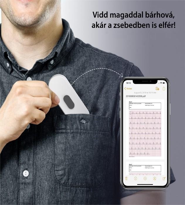 viatom-duo-ekg-a-nyari-utazas-alatt-a-zsebedben-is-elfer