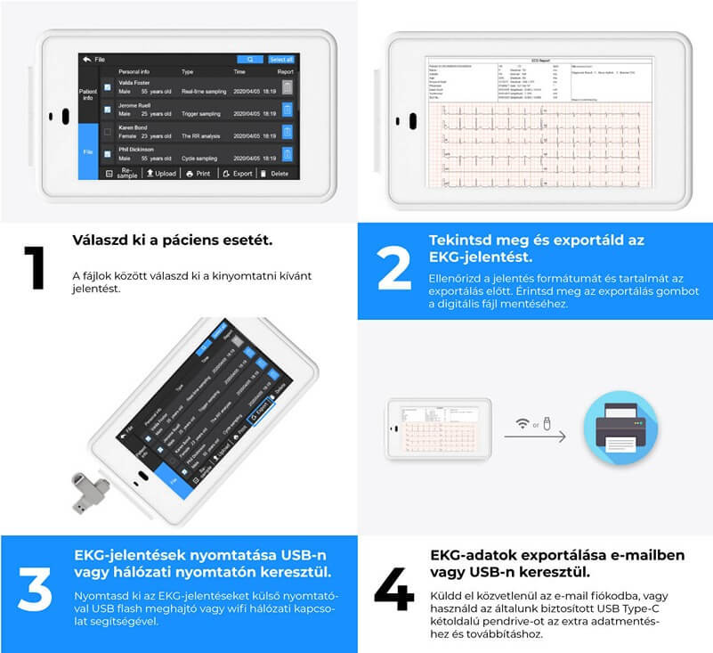 Viatom-ECG-500-6-12-elvezeteses-ekg-keszulek-szoftver