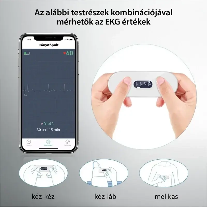 viatom-otthoni-duoekg-kezi-hasznalata