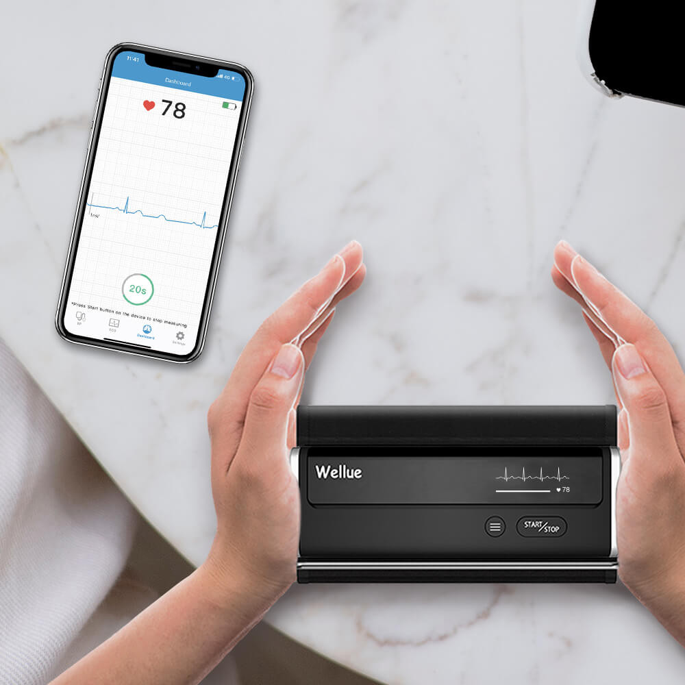 viatom-bp2-wifi-connect-okos-vernyomasmero-ekg-merese-otthon