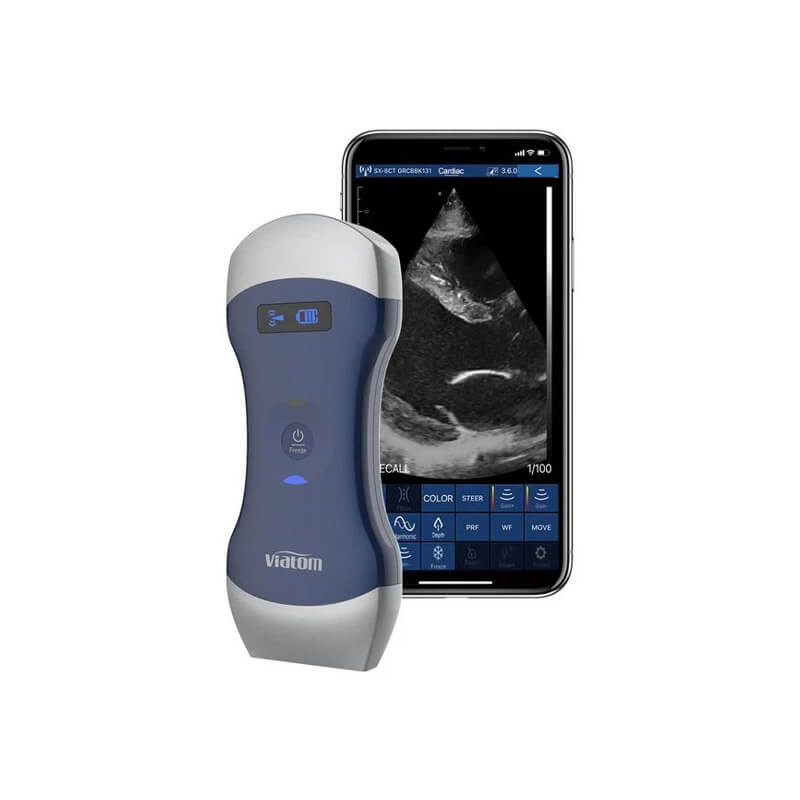 Viatom-Cprobe-CL-vezetek-nelkuli-wifis-kezi-ultrahang-mobilapplikacioval