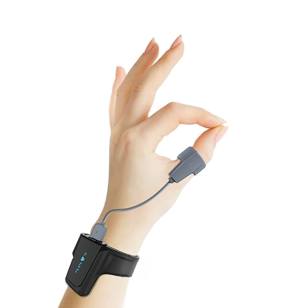 viatom-checkme-o2-mas-egeszsegtudat-okosan-smartmedical