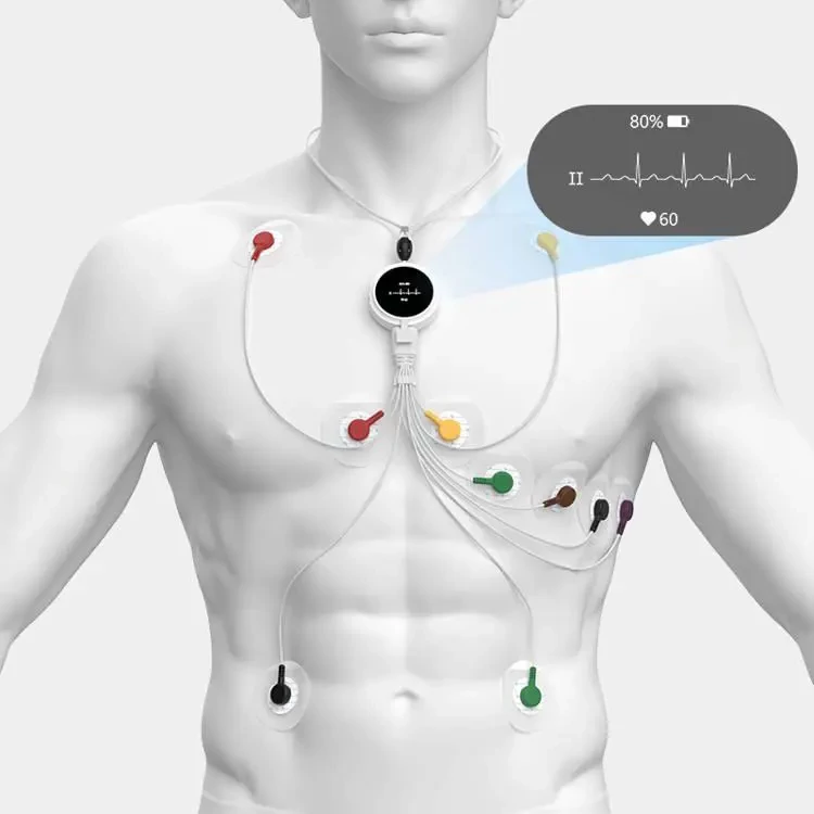 hordozhato-ekg-viatom-lepod-pro-er3-12elvezetes-ekg 