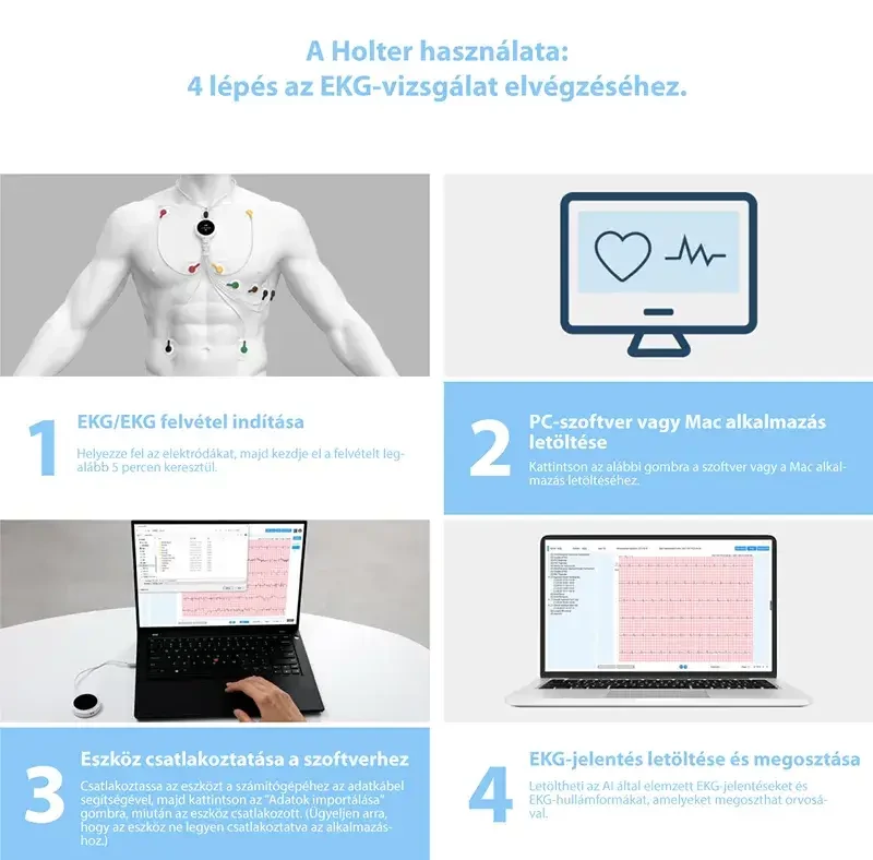 hordozhato-ekg-viatom-lepod-pro-er3-12elvezeteses-ekg