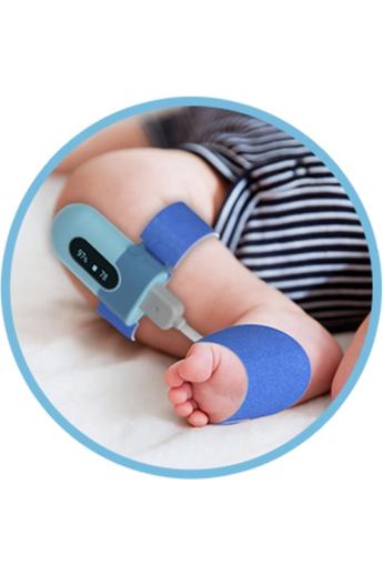 Viatom Baby O2 Légzésfigyelő készülék