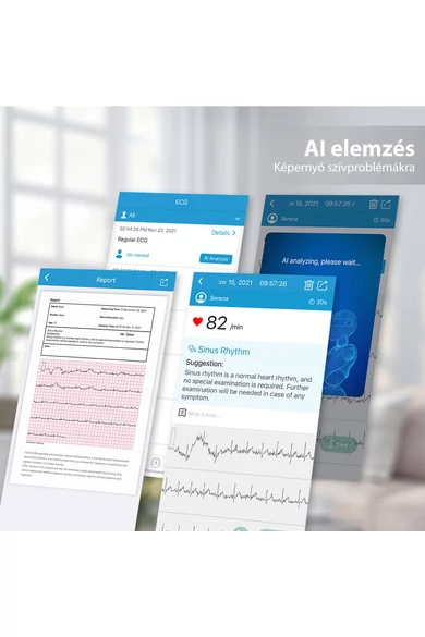 Viatom BP2 Wifi Connect vérnyomásmérő EKG funkcióval