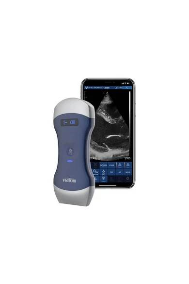 viatom-cprobe-cl-vezetek-nelkuli-kezi-ultrahang-applikacioval