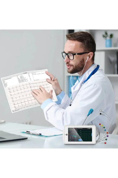 viatom-ecg-500-6-12-elvezeteses-zseb-ekg-keszulek-meresi-eredmenyek