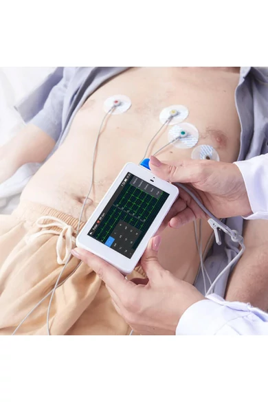 viatom-ecg-500-6-12-elvezeteses-zseb-ekg-keszulek-vizsgalat-a-tenyerben