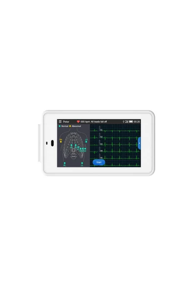 viatom-ecg-500-6-12-elvezeteses-zseb-ekg-keszulek