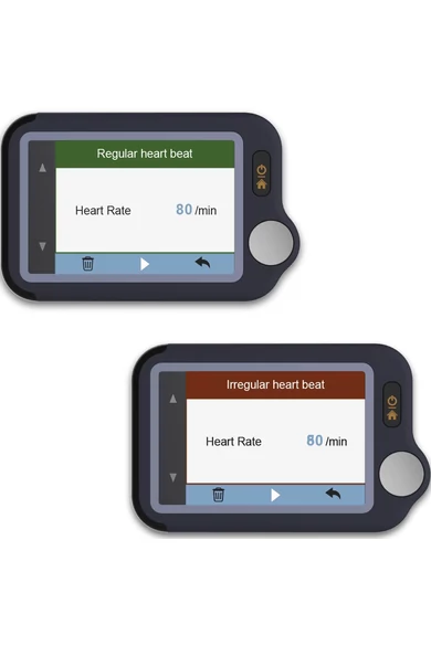 Viatom Pulsebit - Személyi EKG nyomkövető /Egészségmonitor