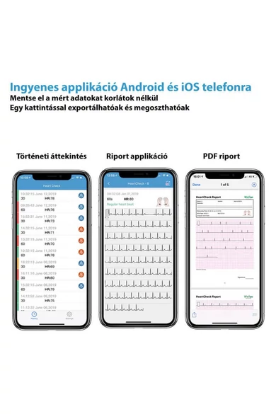 Viatom Pulsebit - Személyi EKG nyomkövető /Egészségmonitor