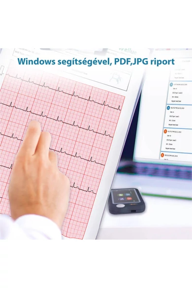 Viatom Pulsebit - Személyi EKG nyomkövető /Egészségmonitor