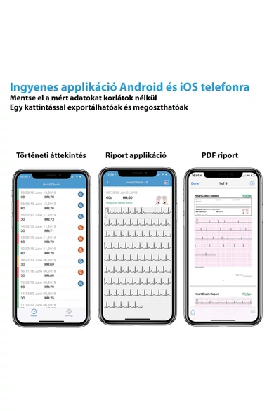 Viatom Pulsebit - Személyi EKG nyomkövető /Egészségmonitor (újracsomagolt)