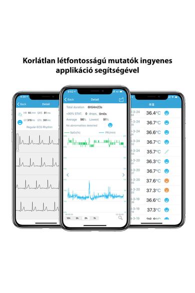 Viatom CheckMe Pro / Öndiagnosztikai EKG