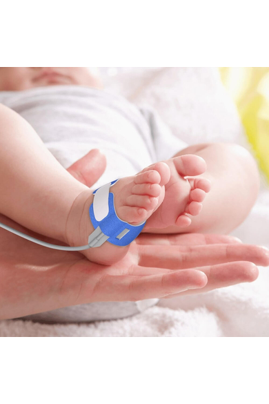 Viatom Baby O2 Légzésfigyelő készülék (Újracsomagolt)
