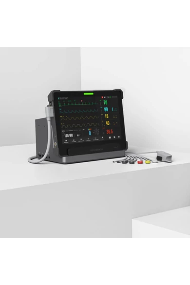 lepu-aiview-vs-vitalparameter-monitor-ekg-meres-4-elektrodaval-beepitett-nyomtatoval