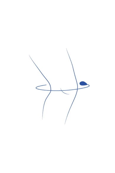 ligaflex-evolution-rom-terdrogzito-03