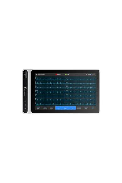 lepu-neo-ecg-s120-hordozhato-professzionalis-ekg-tabletes-keszulek