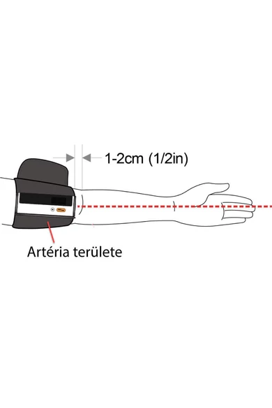 Viatom Armfit+ Vérnyomásmérő EKG funkcióval