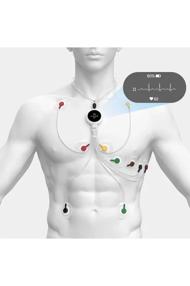 viatom-lepod-pro-er3-7-elvezeteses-24-oras-mini-ekg-holter-monitor-12-elvezetes-felhelyezes