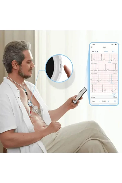 viatom-lepod-pro-er3-7-elvezeteses-24-oras-mini-ekg-holter-monitor-valos-ideju-nyomonkovetes